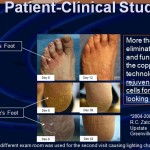 Patient Before and After: Athletes Foot