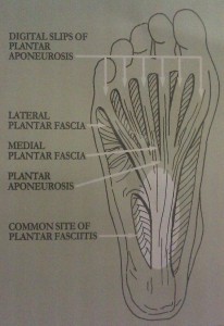Plantars Fasciitis in the Foot Diagram