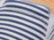 Spenco Siesta Montauk Casual Slip-on Shoe - Women's - Navy Stripe - Detail